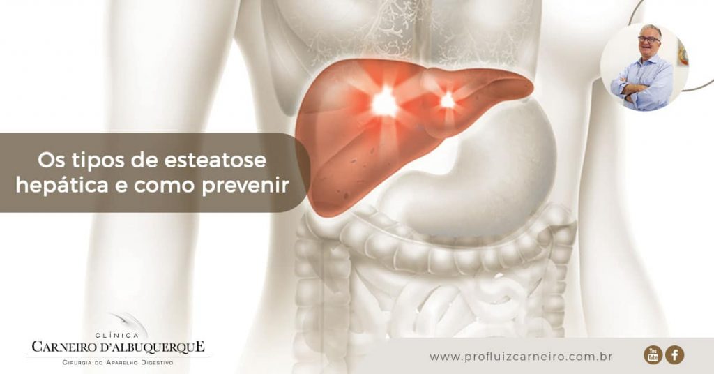 Ao fundo da imagem, há a parte superior de um corpo humano com o fígado em vermelho destacado.