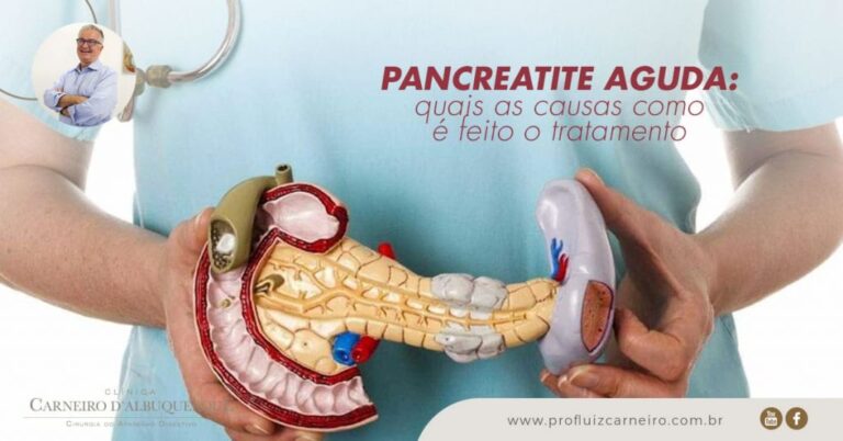 Pancreatite Aguda: Quais As Causas E Como é Feito O Tratamento - Prof ...