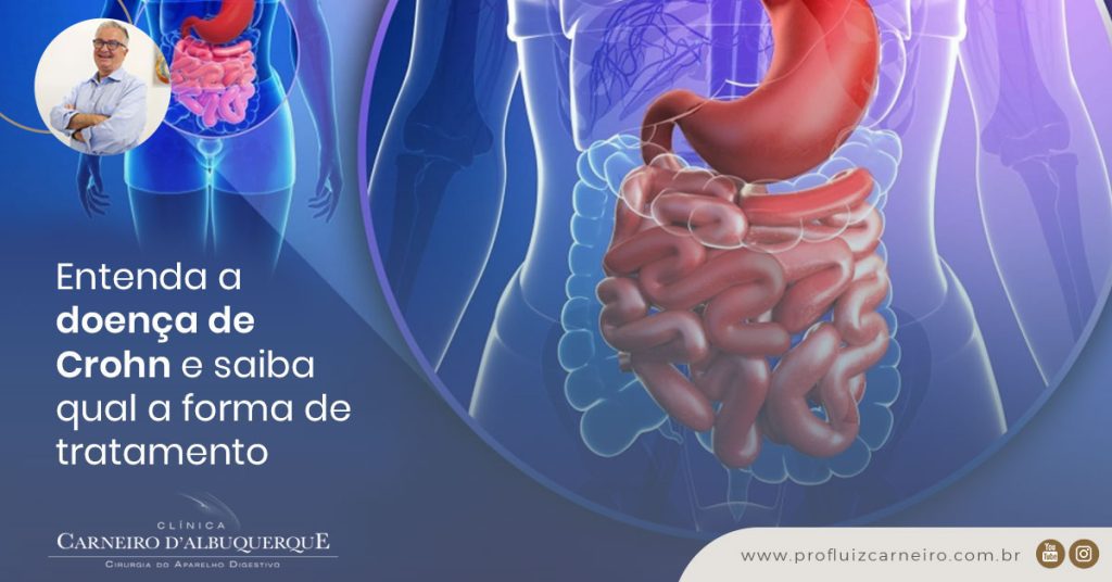 A imagem mostra uma representação gráfica de um sistema digestivo.