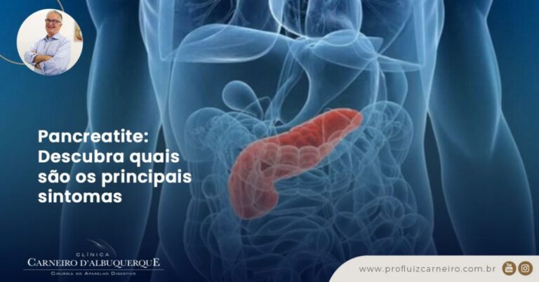 Pancreatite: Descubra Quais São Os Principais Sintomas - Prof Dr. Luiz ...