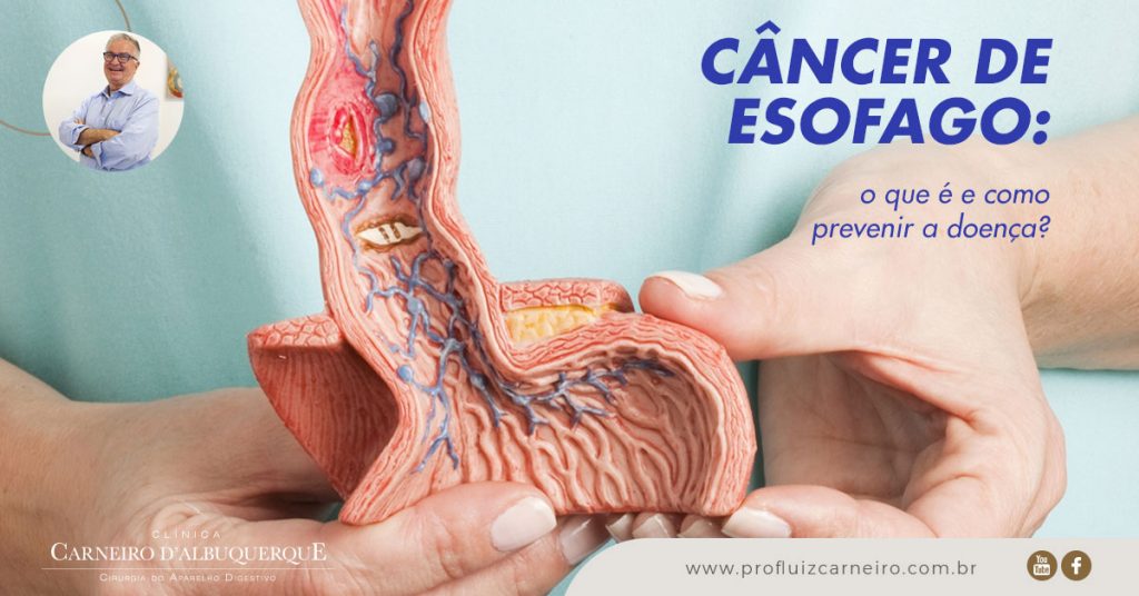 Ao fundo da imagem, há um doutor segurando uma representação de esôfago em borracha.