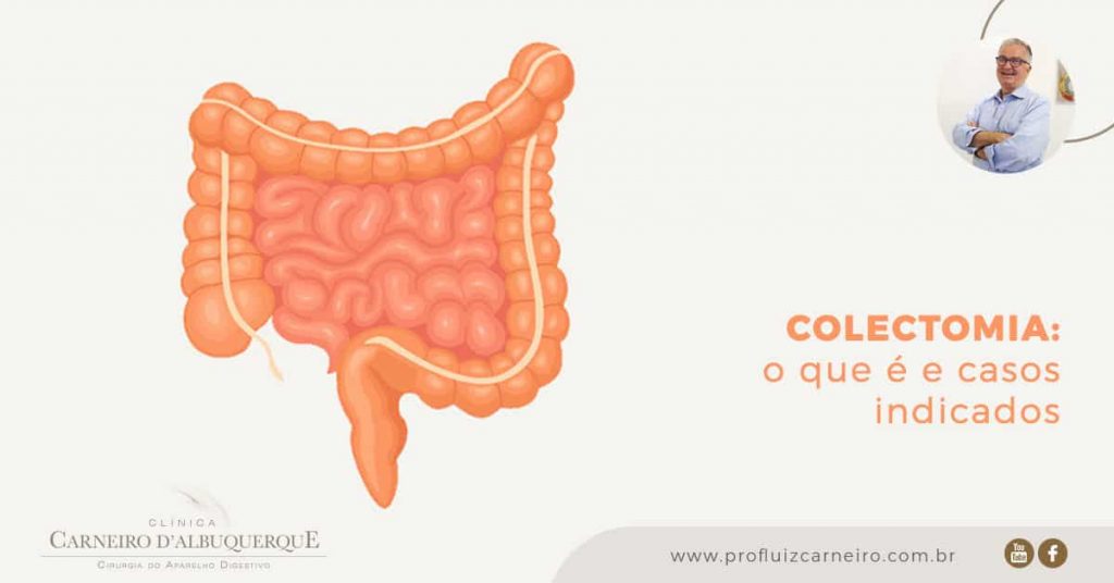 Ao fundo da imagem, há um intestino em laranja.