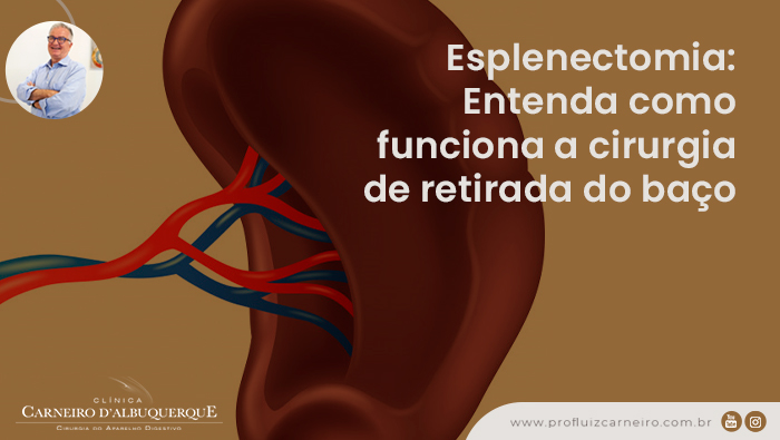 Esplenectomia: Entenda Como Funciona A Cirurgia De Retirada Do Baço ...
