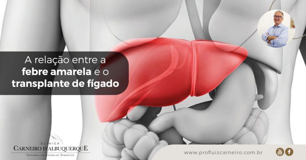 A relação entre a febre amarela e o transplante de fígado | Por Prof Luiz Carneiro CRM 22761 | Diretor do serviço de transplante e cirurgia do fígado do hospital das clínicas da faculdade de medicina da USP.