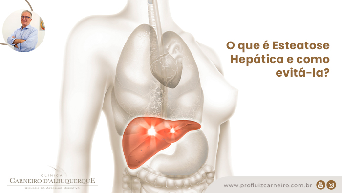 A imagem mostra uma ilustração do corpo humano com o fígado em destaque.