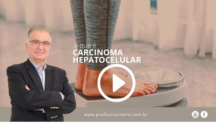 Carcinoma hepatocelular (hepatocarcinoma) : O que é? | Por Prof Luiz Carneiro CRM 22761 | Diretor do serviço de transplante e cirurgia do fígado do hospital das clínicas da faculdade de medicina da USP.