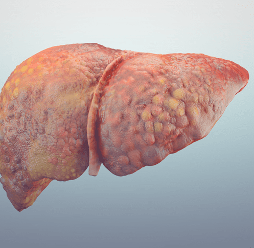 Ao fundo da imagem, há uma ilustração gráfica de um fígado.