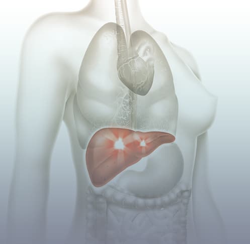 Ao fundo da imagem, há uma representação gráfica de um fígado.