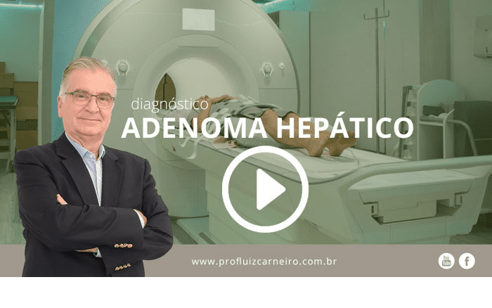 Como é feito o diagnóstico do Adenoma Hepático? | Prof. Dr. Luiz Carneiro - USP - Hospital das Clínicas Divisão de Transplante de Fígado