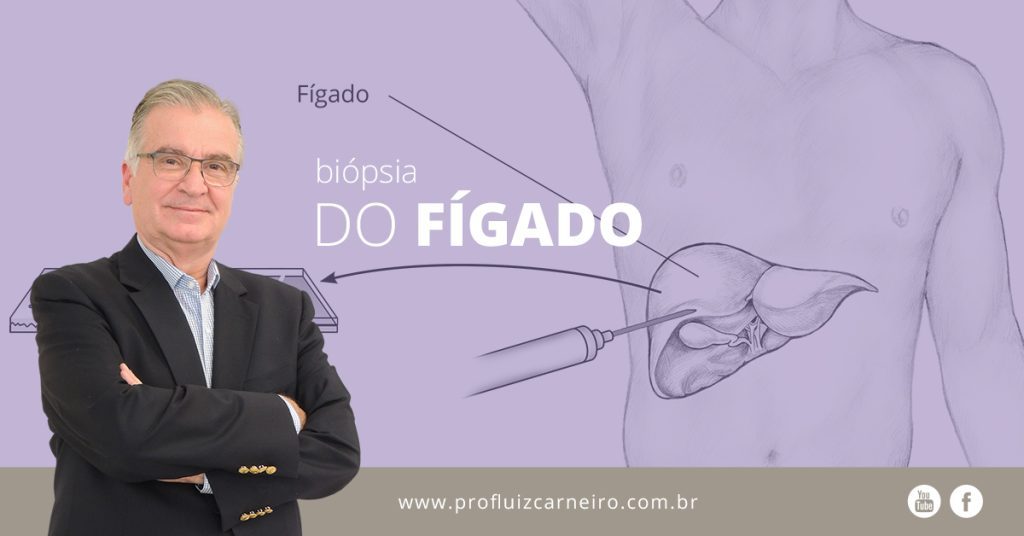 Biópsia do fígado - Por Prof. Dr. Luiz Carneiro - USP - Hospital das Clínicas Divisão de Transplante de Fígado