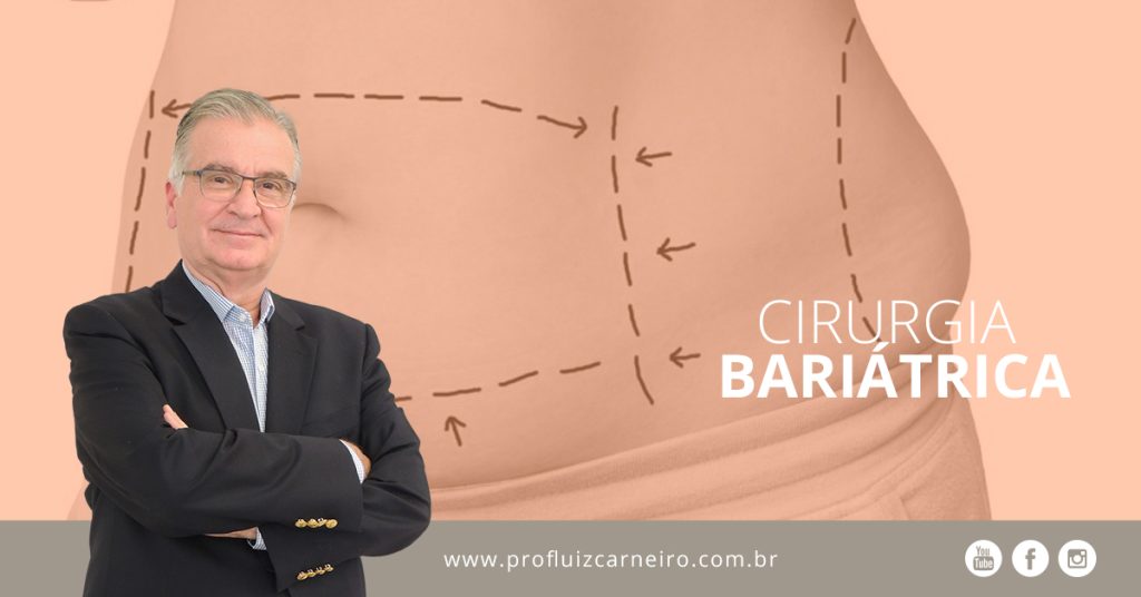 Como são feitas as cirurgias bariátricas | Por Prof Luiz Carneiro CRM 22761 | Diretor do serviço de transplante e cirurgia do fígado do hospital das clínicas da faculdade de medicina da USP.