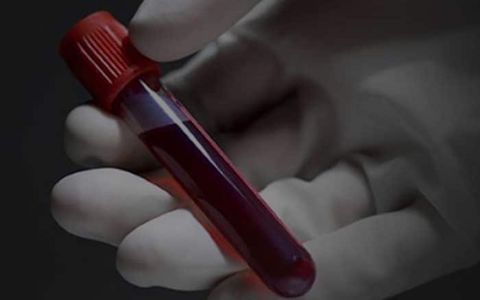 Ao fundo da imagem, há um tubo de sangue, representando o exame de sangue.