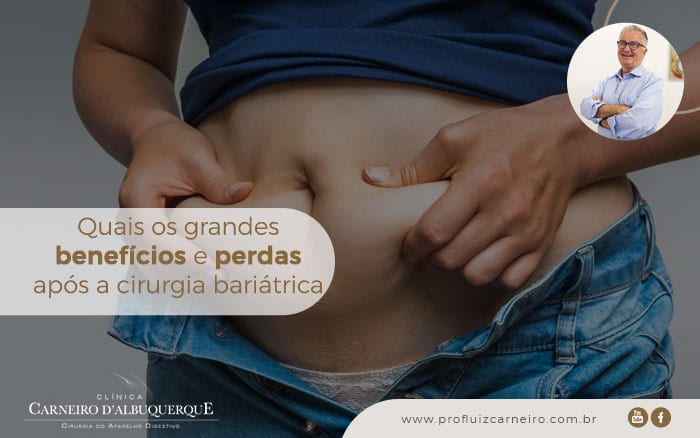 Grandes benefícios e perdas após a cirurgia bariátrica | Por Prof Luiz Carneiro CRM 22761 | Diretor do serviço de transplante e cirurgia do fígado do hospital das clínicas da faculdade de medicina da USP.