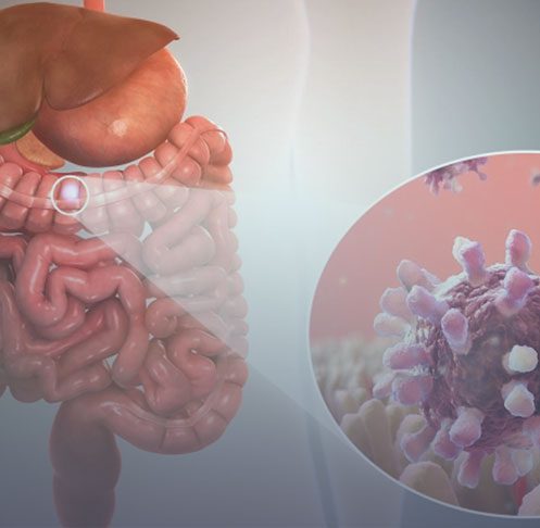 Ao fundo da imagem, há uma ilustração do intestino e o vírus.