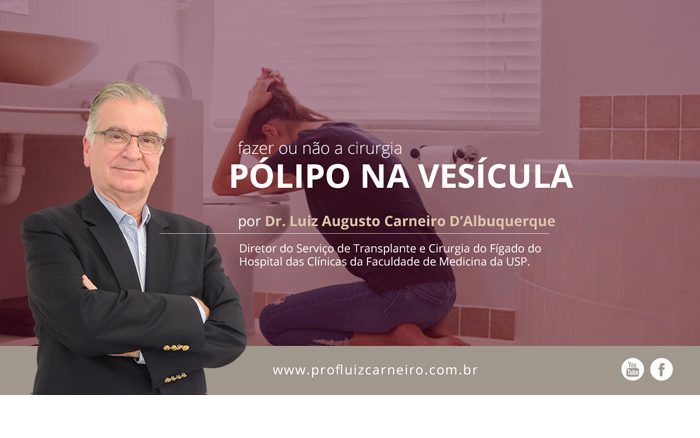 Pólipo na vesícula: fazer ou não a cirurgia? | Por Prof Luiz Carneiro CRM 22761 | Diretor do serviço de transplante e cirurgia do fígado do hospital das clínicas da faculdade de medicina da USP.