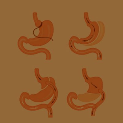 A imagem mostra ilustrações digitais do estômago em 4 posições.