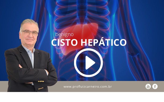 cisto-hepatico-benigno- Por Prof. Dr. Luiz Carneiro - USP - Hospital das Clínicas Divisão de Transplante de Fígado