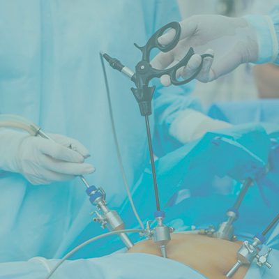 A imagem mostra médicos manoseando pinças que realizam a cirurgia no por via laparoscópica.