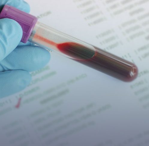 A imagem mostra um profissional da saúde segurando uma amostra de sangue.