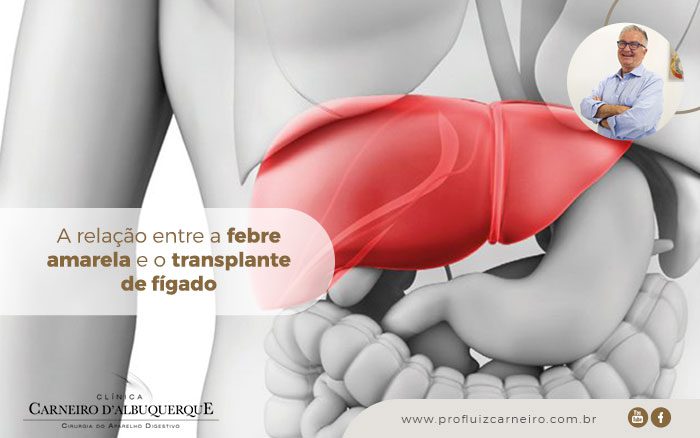 A relação entre a febre amarela e o transplante de fígado | Por Prof Luiz Carneiro CRM 22761 | Diretor do serviço de transplante e cirurgia do fígado do hospital das clínicas da faculdade de medicina da USP.