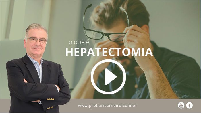 Hepatectomia o que é | Por Prof Luiz Carneiro CRM 22761 | Diretor do serviço de transplante e cirurgia do fígado do hospital das clínicas da faculdade de medicina da USP.
