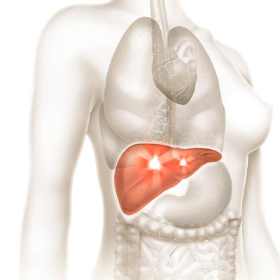 A imagem mostra uma ilustração do corpo humano com o fígado em destaque.
