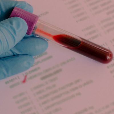 A imagem mostra um profissional da saúde segurando um frasco com uma amostra de sangue.