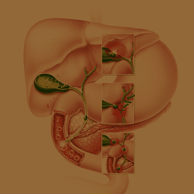 A imagem mostra uma ilustração da vesícula.