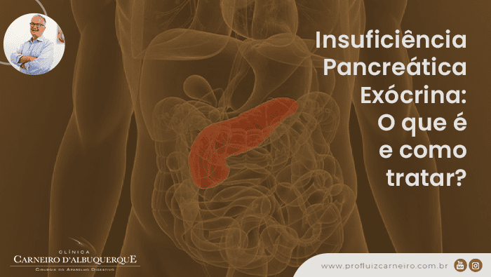 insuficiencia pancreatica exocrina o que e e como tratar prof dr luiz carneiro bg Prof Dr. Luiz Carneiro