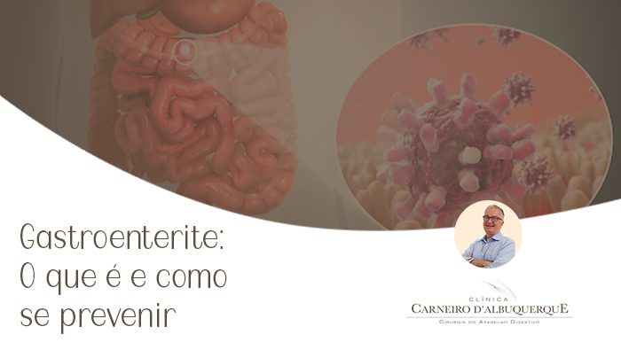gastroenterite o que e e como se prevenir prof dr luiz carneiro bg Prof Dr. Luiz Carneiro