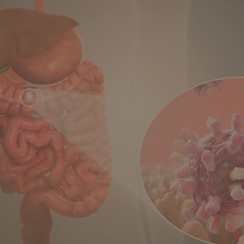 A imagem mostra a ilustração do aparelho digestivo e uma bactéria ao lado.