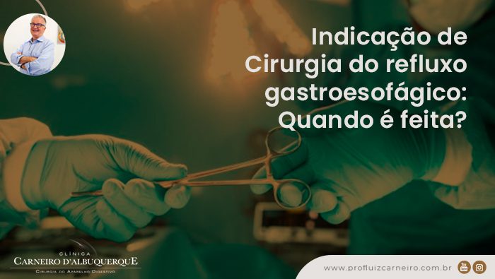 indicacao de cirurgia do refluxo gastroesofagico quando e feita prof dr luiz carneiro bg 1 Prof Dr. Luiz Carneiro