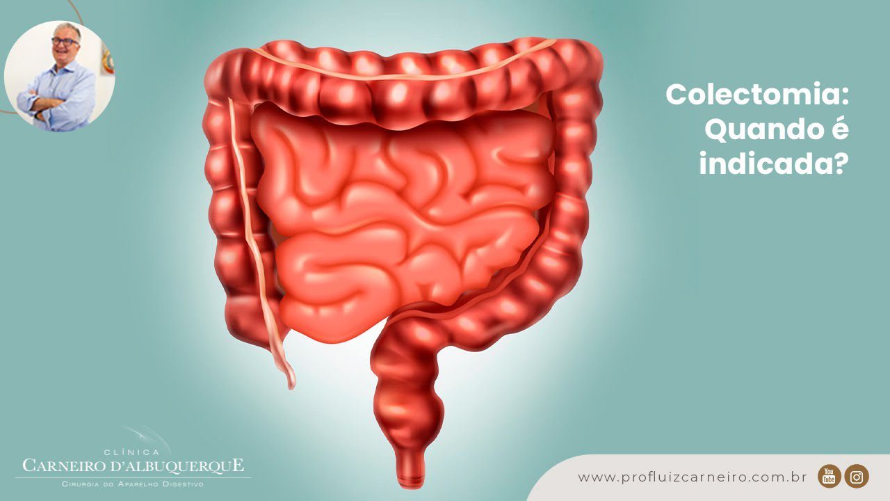 Quem fez cirurgia de vesícula pode se abaixar? Confira aqui!