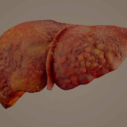 A imagem mostra uma ilustração digital de um fígado.
