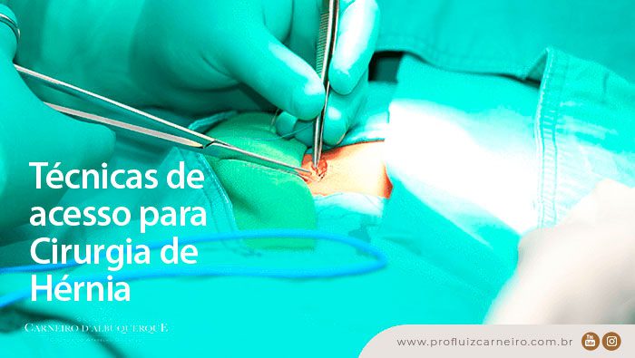 tecnicas de acesso para cirurgia de hernia prof dr luiz carneiro bg Prof Dr. Luiz Carneiro
