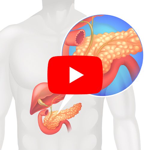 A imagem ilustra um corpo humano, destacando o pâncreas