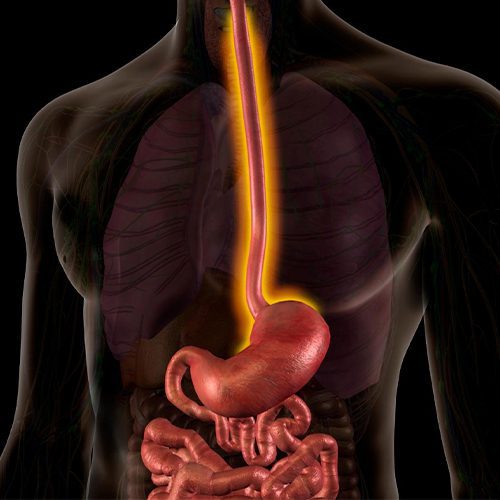 a imagem ilustra um corpo humano e o sistema digestivo, em destaque está o esôfago