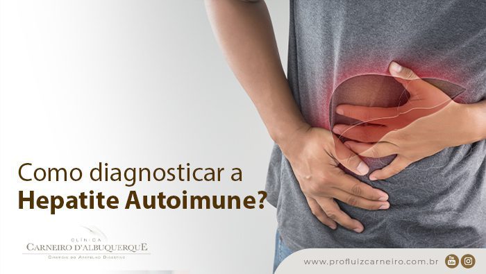 como diagnosticar a hepatite autoimune prof dr luiz carneiro bg Prof Dr. Luiz Carneiro