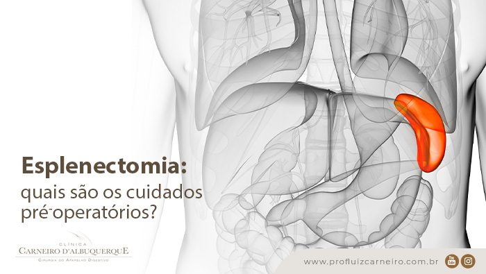 esplenectomia quais sao os cuidados pre operatoriosnbsp blog Prof Dr. Luiz Carneiro
