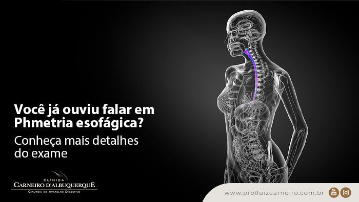 voce ja ouviu falar em phmetria esofagica conheca mais detalhes do exame prof dr luiz carneiro bg Prof Dr. Luiz Carneiro