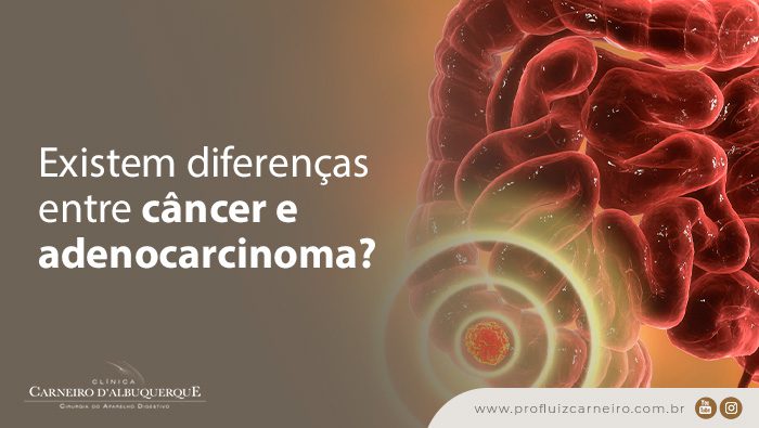existem diferencas entre cancer e adenocarcinoma blog Prof Dr. Luiz Carneiro
