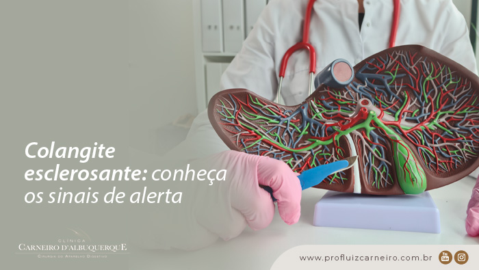 colangite esclerosante conheca os sinais de alerta BLOG Prof Dr. Luiz Carneiro