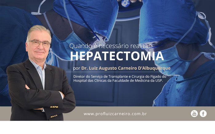 Quando é necessário realizar a hepatectomia? | Por Prof Luiz Carneiro CRM 22761 | Diretor do serviço de transplante e cirurgia do fígado do hospital das clínicas da faculdade de medicina da USP.