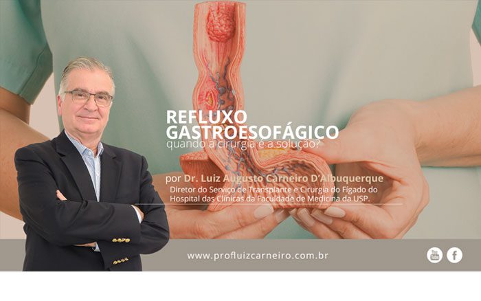 Refluxo Gastroesofágico: quando a cirurgia é a solução? | Por Prof Luiz Carneiro CRM 22761 | Diretor do serviço de transplante e cirurgia do fígado do hospital das clínicas da faculdade de medicina da USP.