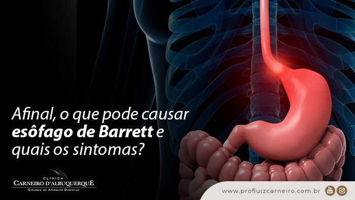 afinal o que pode causar esofago de barrett e quais os sintomas prof dr luiz carneiro bg