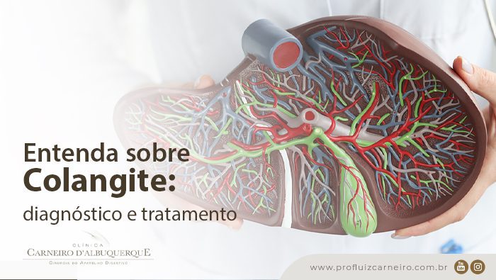 entenda sobre colangite diagnostico e tratamento prof dr luiz carneiro bg