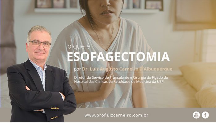 Esofagectomia: o que é? | Por Prof Luiz Carneiro CRM 22761 | Diretor do serviço de transplante e cirurgia do fígado do hospital das clínicas da faculdade de medicina da USP.