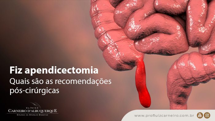 fiz apendicectomia quais sao as recomendacoes pos cirurgicas dr prof luiz carneiro bg