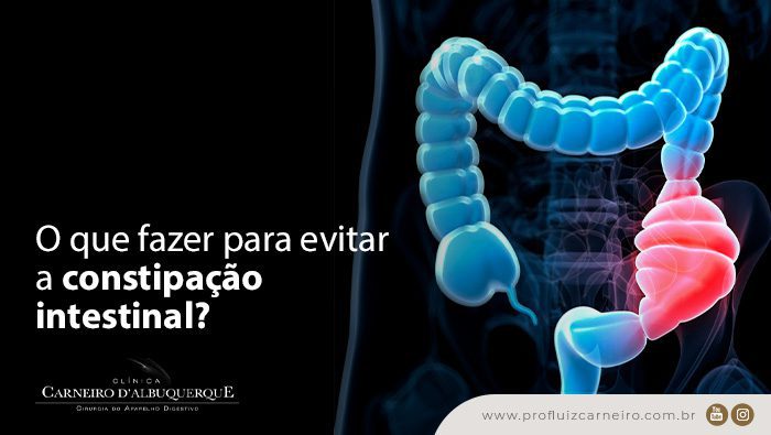 o que fazer para evitar a constipacao intestinal prof dr luiz carneiro bg