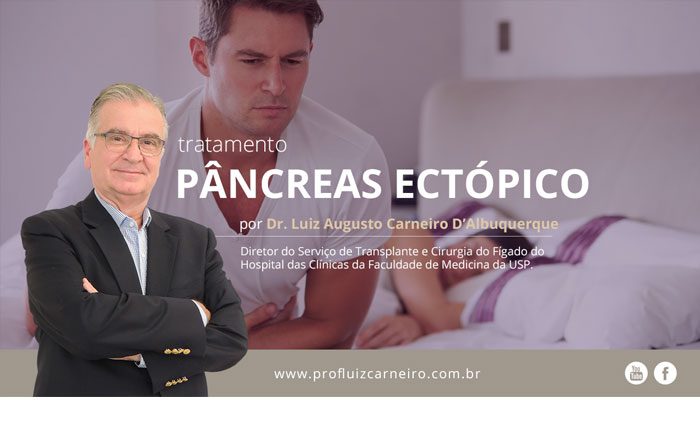 Pâncreas ectópico: tratamento | Por Prof Luiz Carneiro CRM 22761 | Diretor do serviço de transplante e cirurgia do fígado do hospital das clínicas da faculdade de medicina da USP.